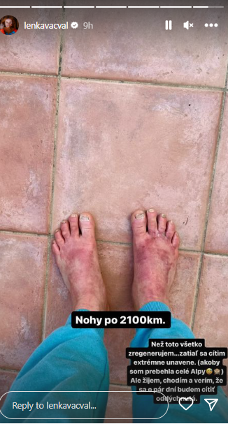 Nohy Lenky Poláčkovej po 39 dňoch behu.