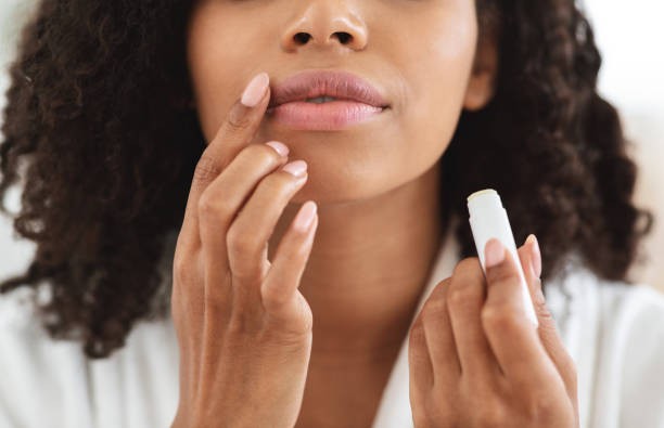 Lipbalm keeps your lips moisturised [iStock]