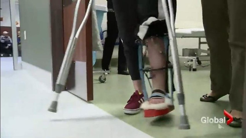 Oporavak traje duže nego sama procedura