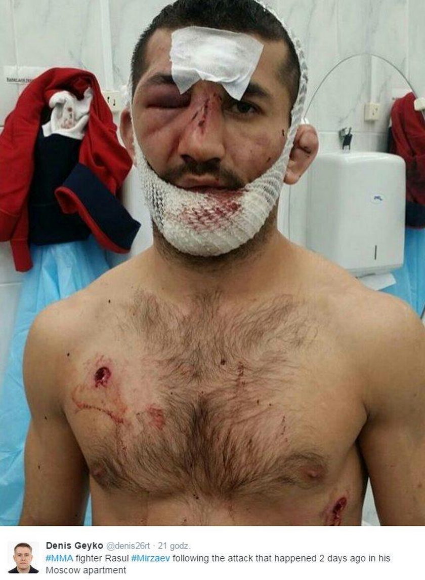 Rasuł Mirzajew, rosyjski zawodnik MMA, został zaatakowany we własnym mieszkaniu