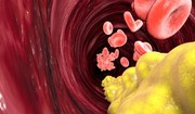  Cholesterol HDL - normy, rola. Jak podnieść poziom dobrego cholesterolu HDL? 