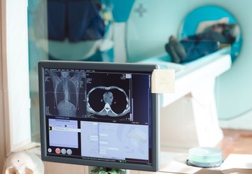 Teljes test MRI-vizsgálat: segíthet hamarabb felismerni a daganatot