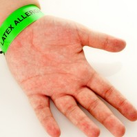 Latex allergia