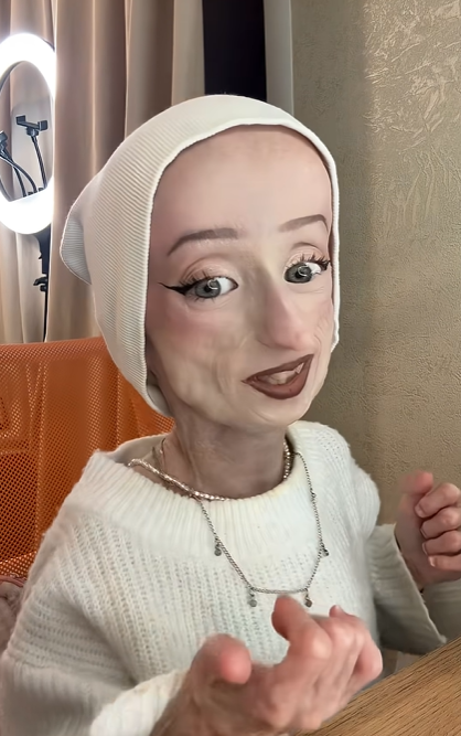 Napriek vážnemu ochoreniu žije Anna svoj život naplno.