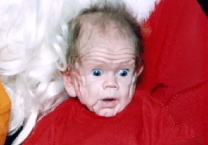 Jeho výzor prekvapil lekárov aj rodičov.