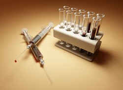 Przewlekła białaczka limfocytowa. Co musisz o niej wiedzieć?