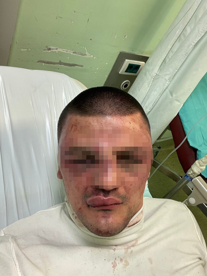 .Ognjenovo lice prekriveno je podlivima, modricama i krvlju