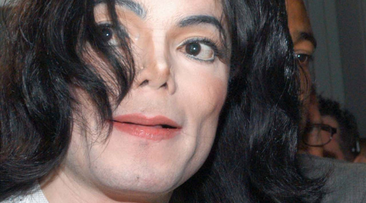 Michael Jackson orra eldeformálódott a műtétektől, ezért implantátumot viselt /Fotó: Northfoto