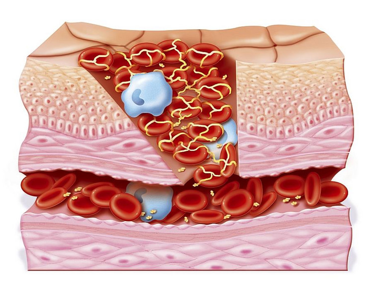 Anatomia rany