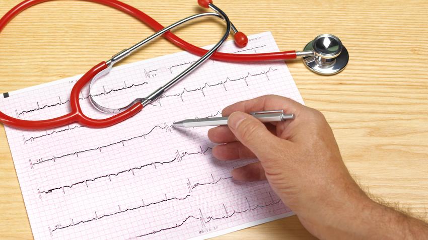 megvastagodott szív tünete EKG vizsgálat eltérés