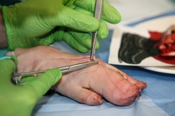 Mistrzostwa Polski w szyciu chirurgicznym. Poznaliśmy najlepszych