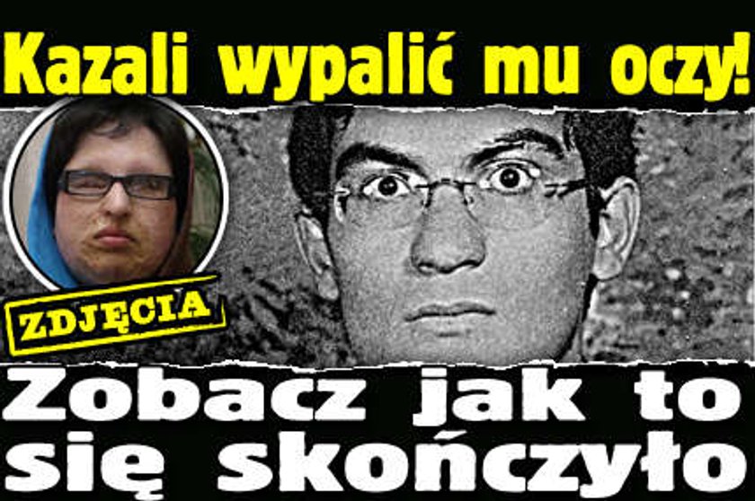 Kazali wypalić mu oczy. Zobacz jak to się skończyło