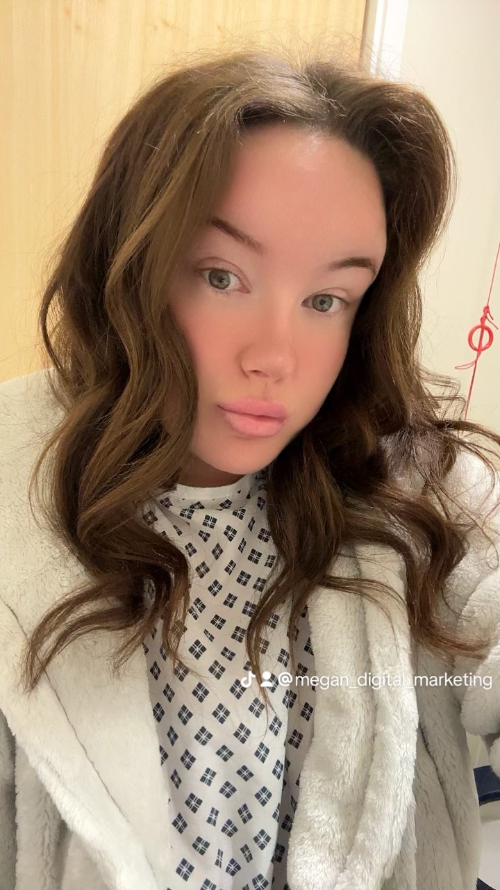 Megan Jackson roky trpela občasnými ochromujúcimi bolesťami hlavy.