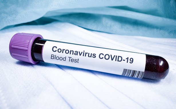 Test na koronawirusa, Covid-19
