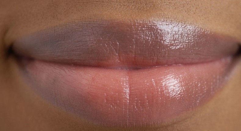 Dark lips can also be triggered by skin disorders, chemical and other lifestyle factors