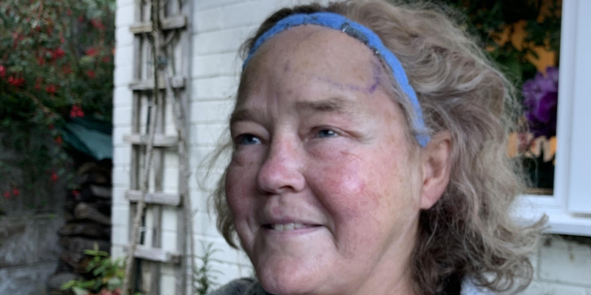 Wakacyjne zatrucie pokarmowe 58-latki uratowało jej życie. Dostała diagnozę.