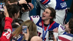 bohater usa przebiera w ofertach... dentystów. chcą mu wstawić nowe zęby