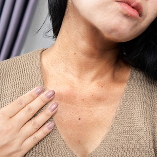 Gyanús foltok, göbök, elszíneződések a bőrön: ekkor jelez pajzsmirigyzavart