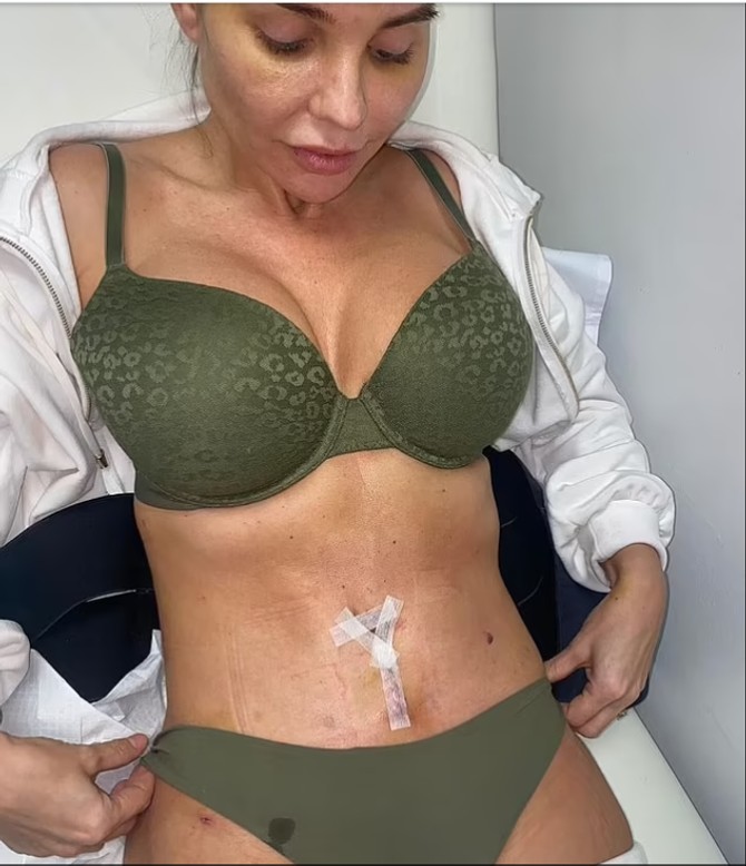 Tanja posle operacije