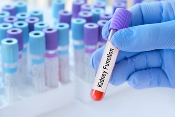 Ilyen laboreredmények utalhatnak vesebetegségre