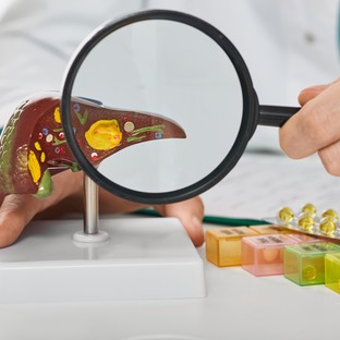 Májrák: legfontosabb jellemzői, tünetei, diagnosztikája és kezelési lehetőségei