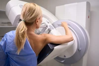 Mammografia nie zawsze wystarcza. "Niektóre kobiety powinny robić inne badania"
