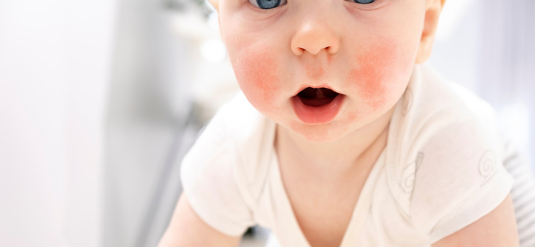 Mróz i suche powietrze w domu. Jak dbać o skórę dziecka zimą?