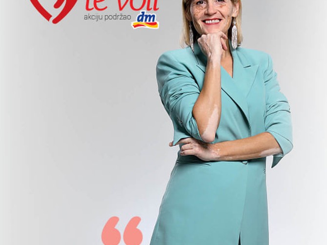 Ja sam Bojana i imam vitiligo i dijabetes