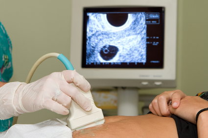 Zmiany w prawie aborcyjnym w Danii. Usunięcie ciąży możliwe do 18. tygodnia