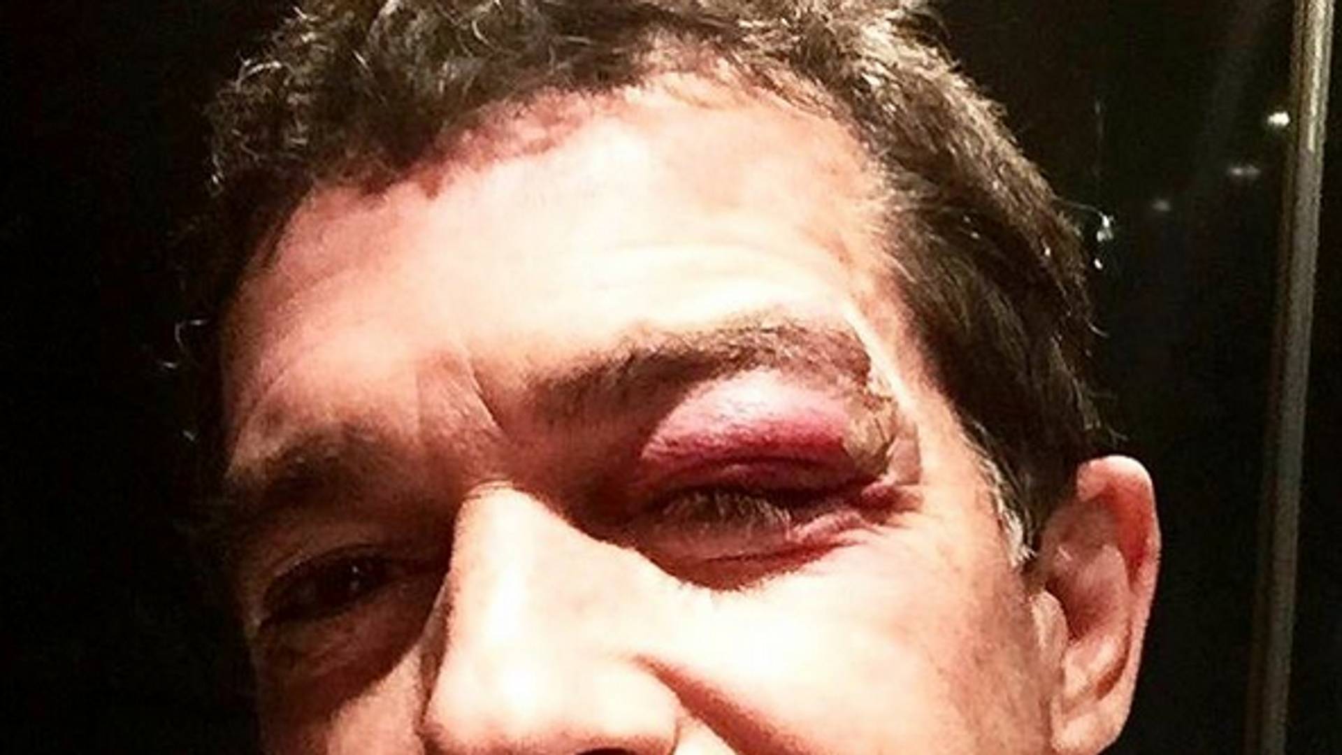 Antonio Banderas hitno hospitalizovan