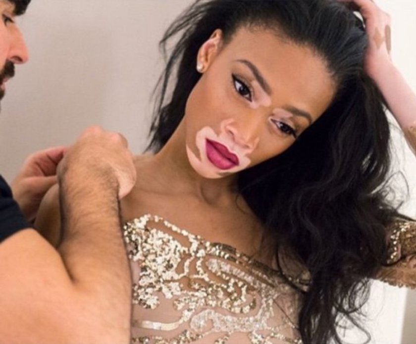 Winnie Harlow