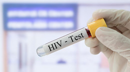 Mazowieckie przychodnie zlecają ciężarnym badania w kierunku HIV