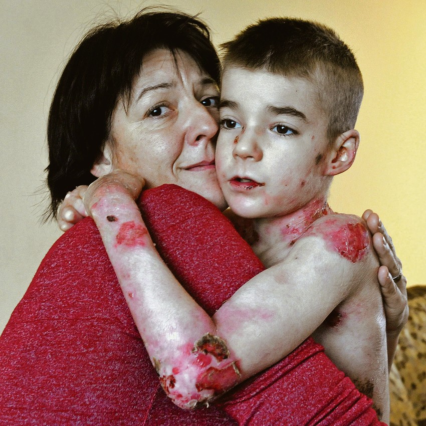 Despot sve teže
hoda, zbog čega
će mu biti potrebna kolica