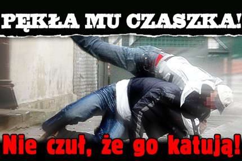 Pękła mu czaszka! Nie czuł, że go katują!