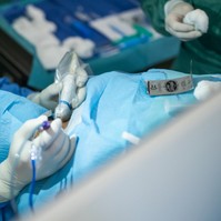Mellékpajzsmirigy megnagyobbodást kezeltek termoablációval a Semmelweisen