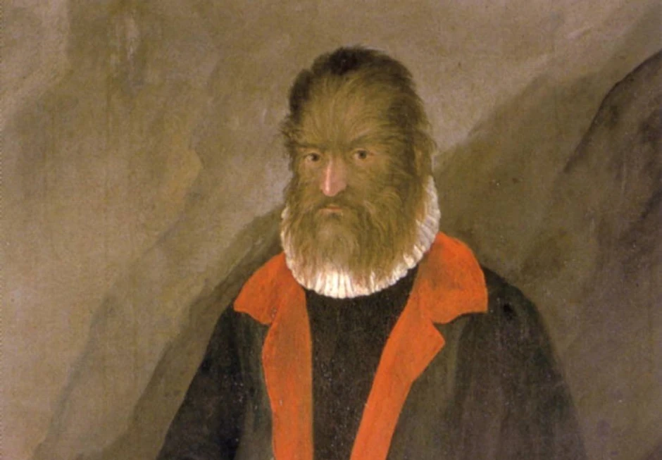Petrus Gonsalvus