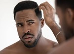Stress and 5 other unexpected causes of dandruff