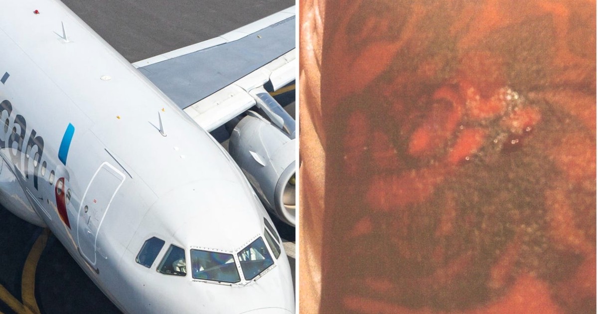 An American Airlines passenger says he got severe injuries after being ...