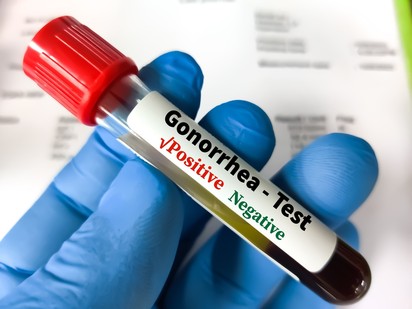 Engedélyezték a chlamydia és a gonorrhoea első otthoni tesztjét