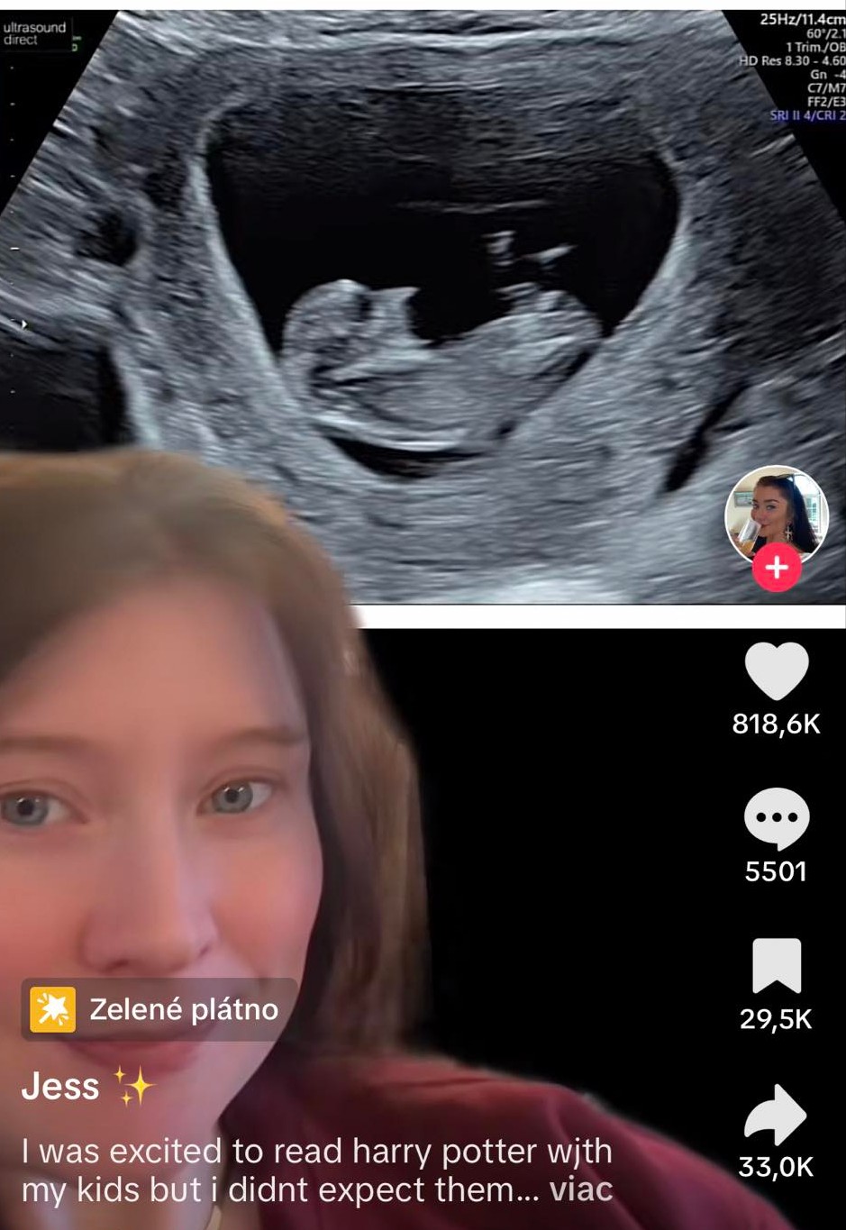 Žena ostala zhrozená z fotografie ultrazvuku.