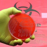 Új, izgalmas antibiotikumiot fedezett fel a mesterséges intelligencia