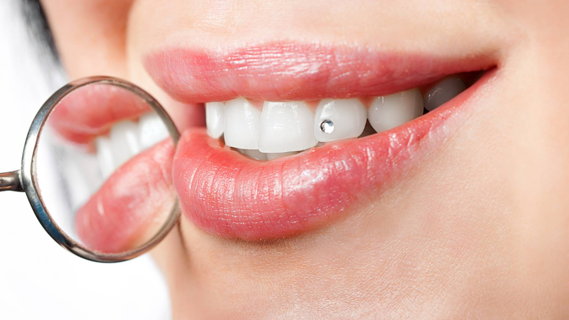 Tooth gems, czyli kryształki na zęby. Ten urodowy trend stał się hitem