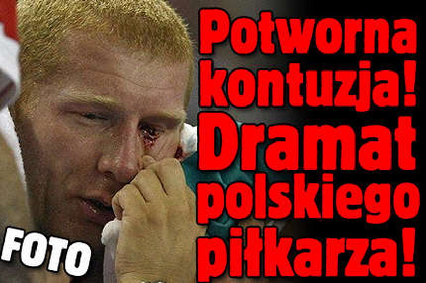 Potworna kontuzja! Polski piłkarz o mało nie stracił oka! FOTO