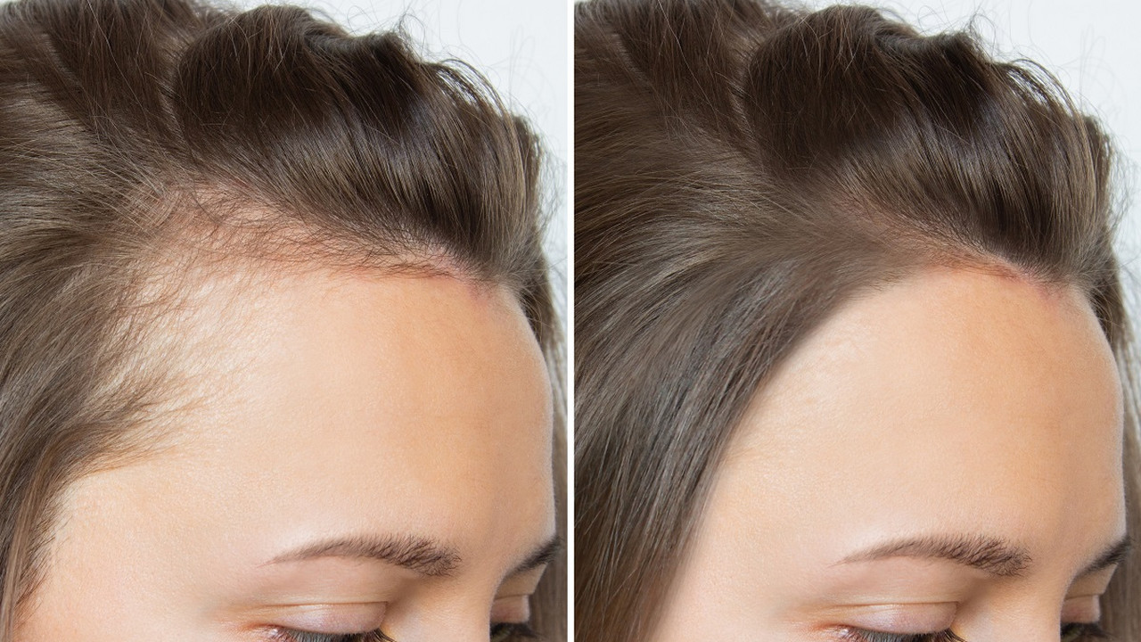 Szybkie i skuteczne odżywki — stymulują mieszki, poprawiają gęstość włosów