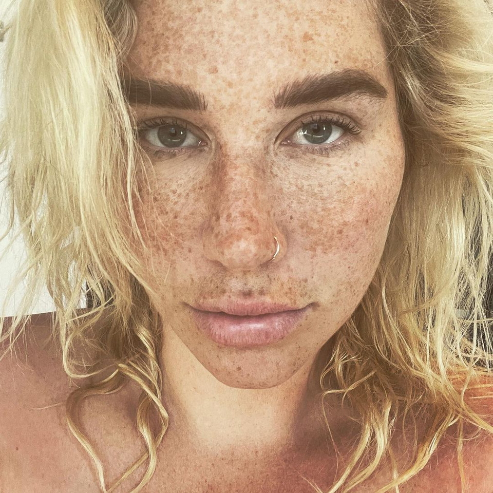 Kesha