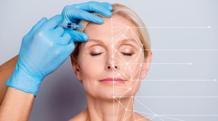Amit a botox-kezelésről tudni érdemes Fotó: Getty Images