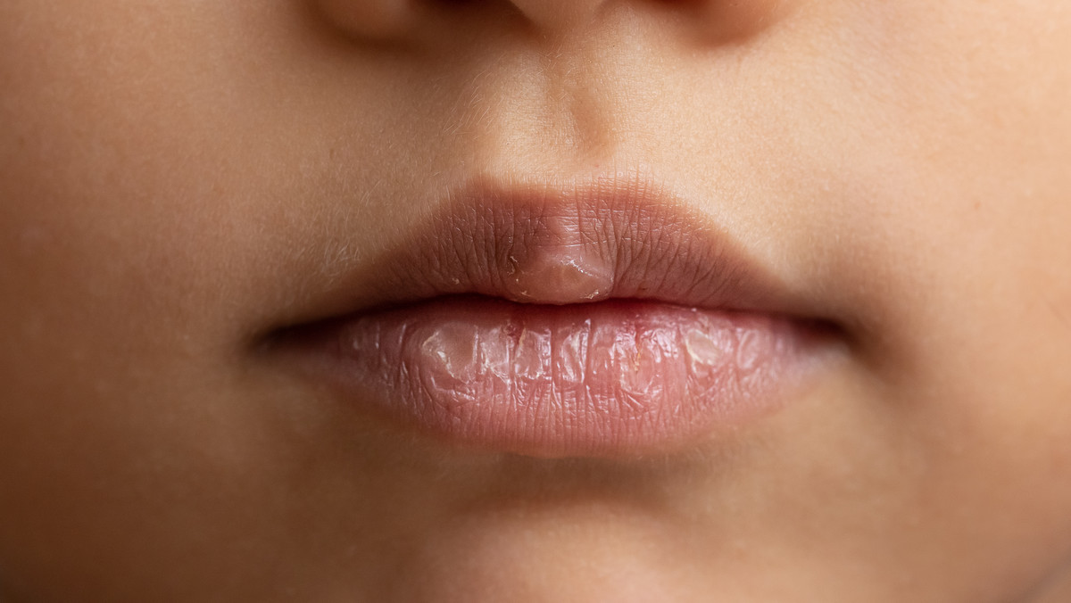 Peeling do ust — dlaczego warto go używać?