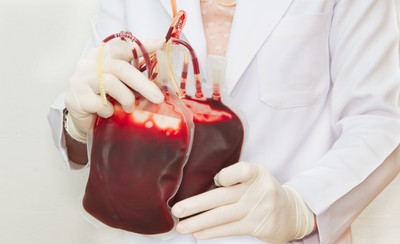 Majonez i chałwa zamiast czekolady za oddanie krwi w Krakowie