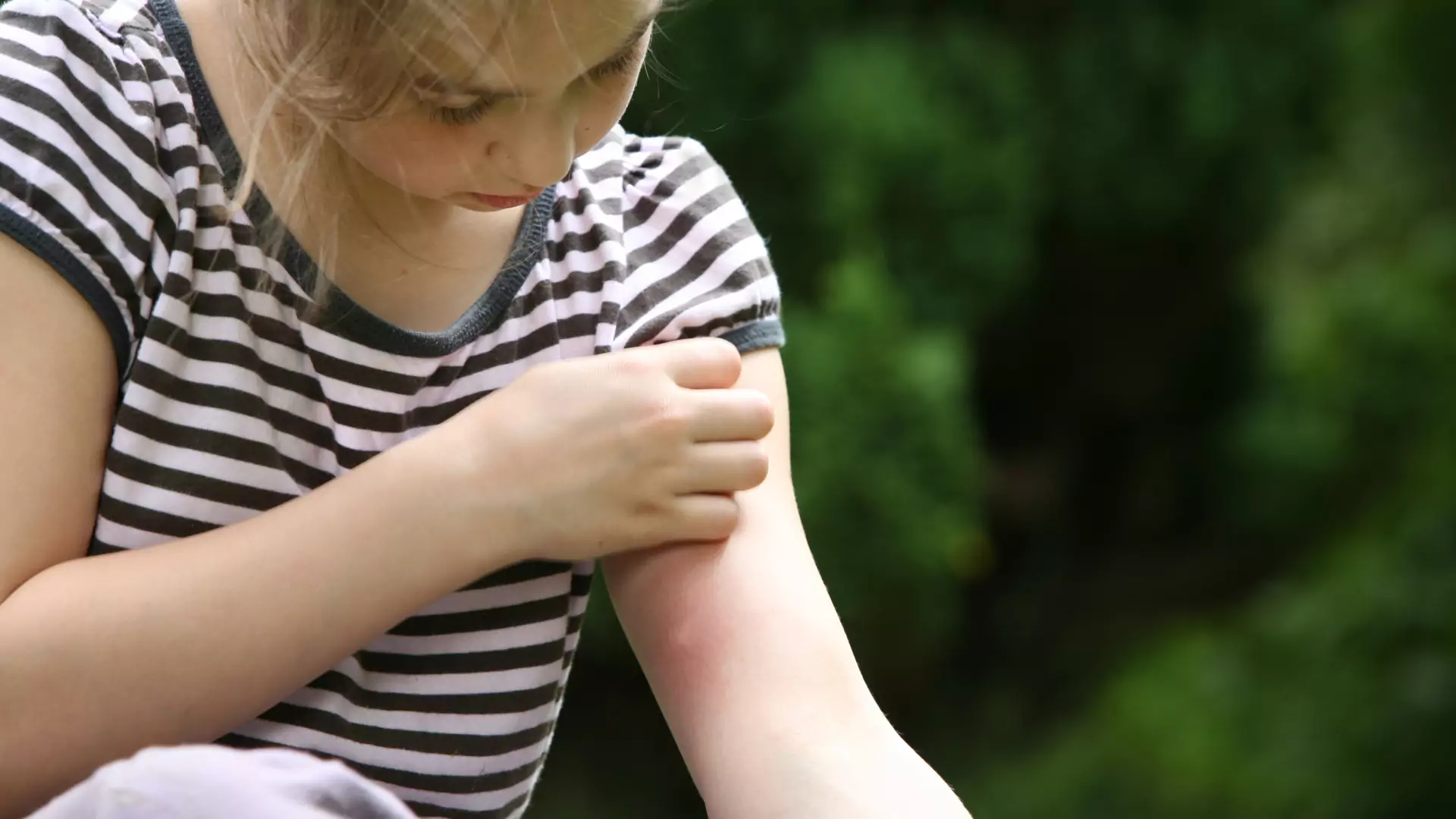 Naturalne sposoby na komary, które odstraszają nieproszonych gości