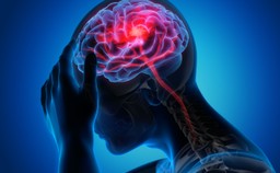 udar mózgu a regeneracja. nowe spojrzenie na mechanizmy neuroplastyczn